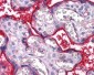 ITGA5/Integrin Alpha 5/CD49e Antibody (clone 10F6)